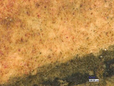 photomicrograph