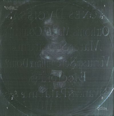 x_radiograph