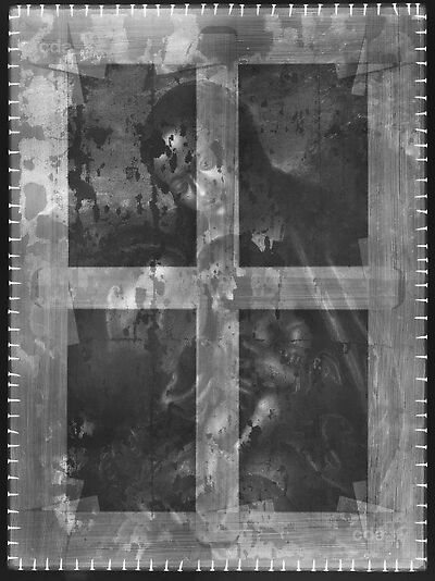 x_radiograph
