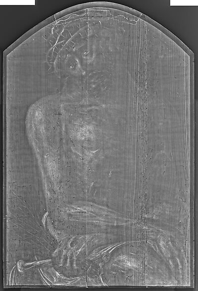 x_radiograph
